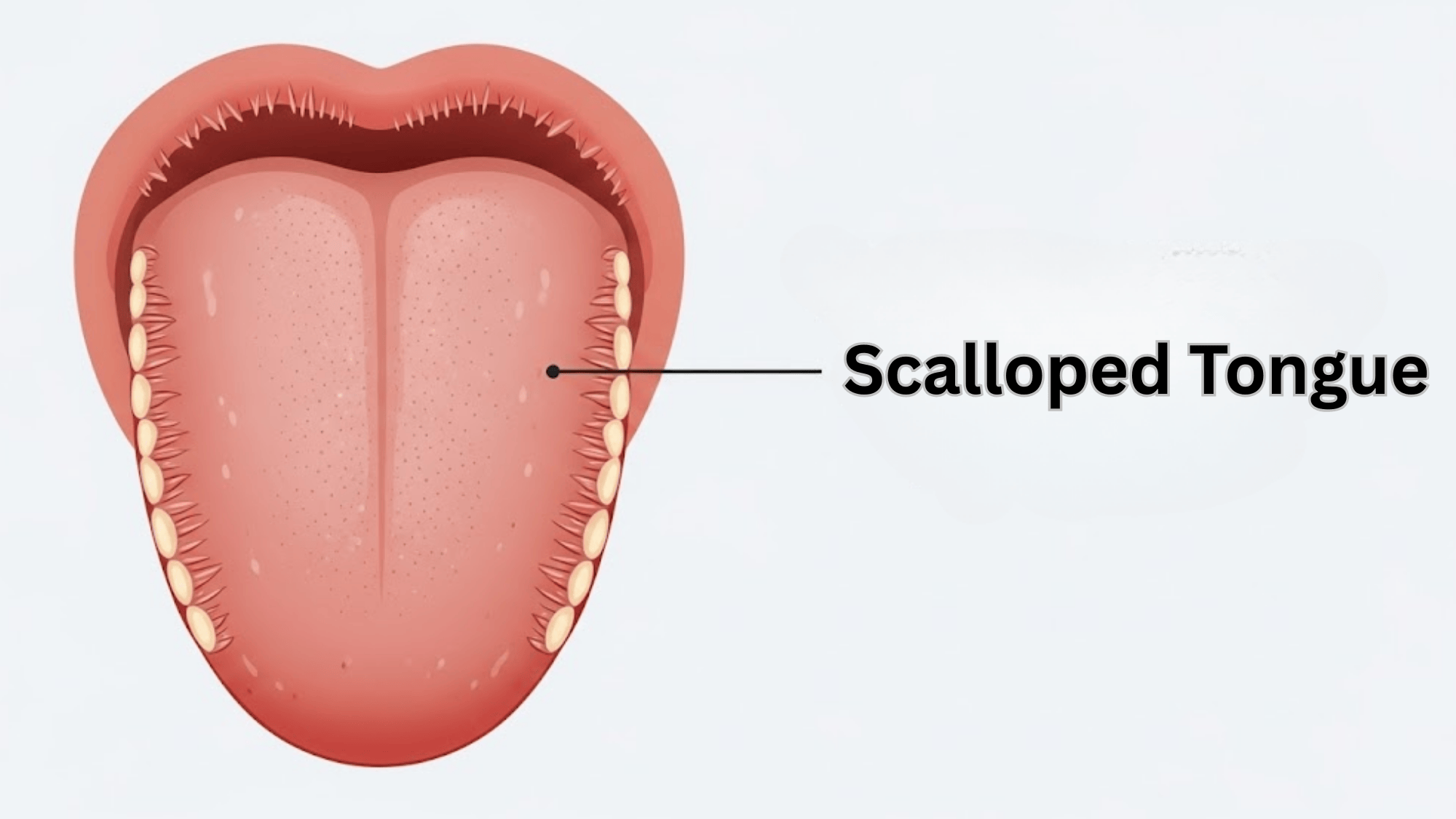 Scalloped-Tongue